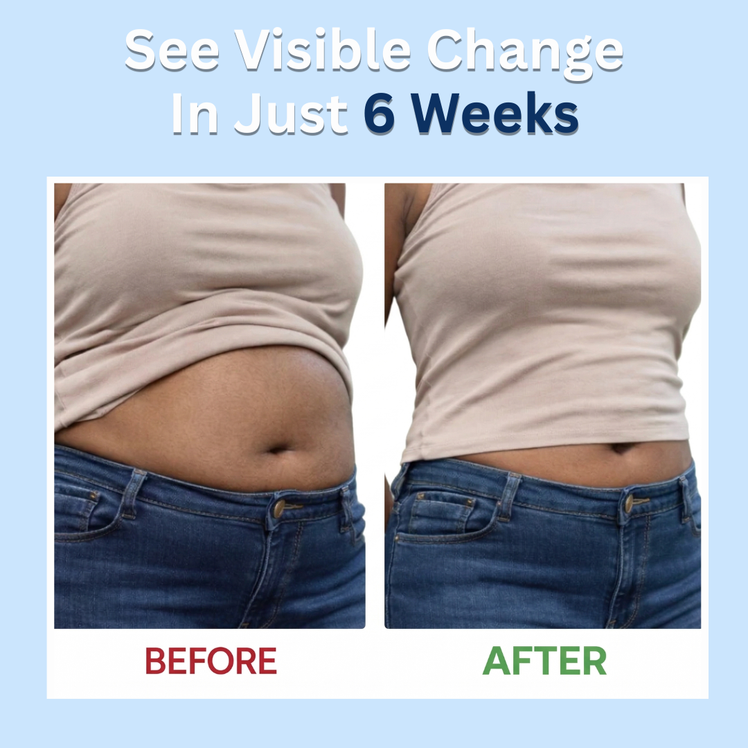 Slimbiosys Probiotic