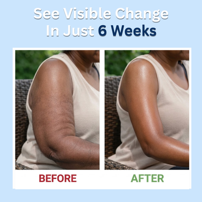 Slimbiosys Probiotic