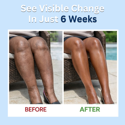 Slimbiosys Probiotic